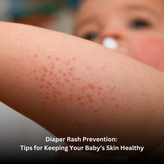 Diaper Rash Prevention: Tips for Keeping Your Baby’s Skin Healthy